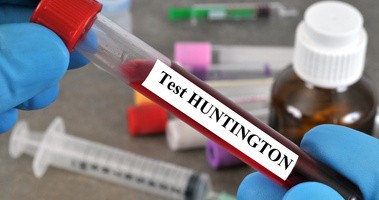 Pląsawica Huntingtona – przyczyny, objawy, leczenie, rokowania w chorobie Huntingtona