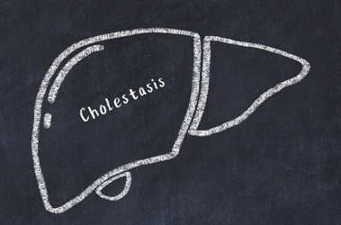 Cholestaza – przyczyny, objawy, rodzaje, diagnostyka, leczenie