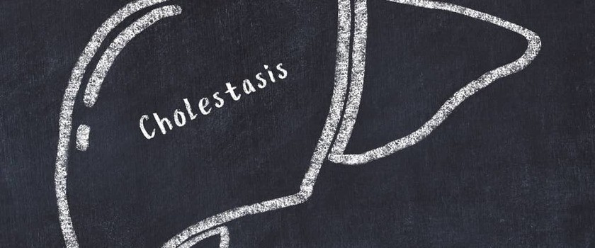 Cholestaza – przyczyny, objawy, rodzaje, diagnostyka, leczenie