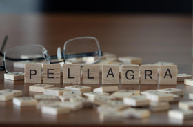Pelagra (rumień lombardzki) - objawy skórne oraz ogólnoustrojowe