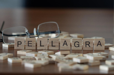 Pelagra (rumień lombardzki) - objawy skórne oraz ogólnoustrojowe