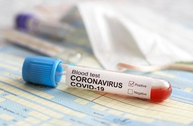 Koronawirus SARS-CoV-2 i choroba COVID-19 – fakty i mity