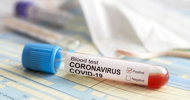 Koronawirus SARS-CoV-2 i choroba COVID-19 – fakty i mity