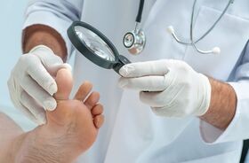 czerniak paznokcia, dermatoskopia paznokcia, czerniak złośliwy na paznokciu, 