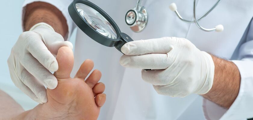 czerniak paznokcia, dermatoskopia paznokcia, czerniak złośliwy na paznokciu, 