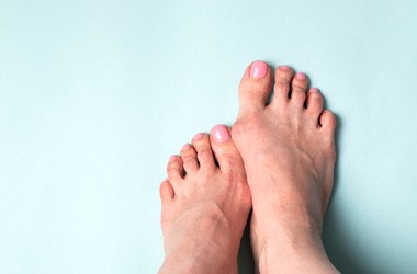 Haluksy – przyczyny, objawy, leczenie palucha koślawego. Ćwiczenia na haluksy
