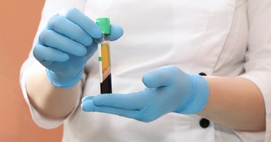 Transfuzja osocza może pomóc w leczeniu chorych z koronawirusem