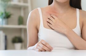 alergia skórna, alergie skórne, wysypka na skórze, uczulenie, wysypka na rękach