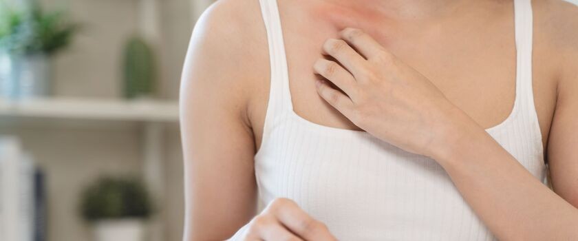 alergia skórna, alergie skórne, wysypka na skórze, uczulenie, wysypka na rękach