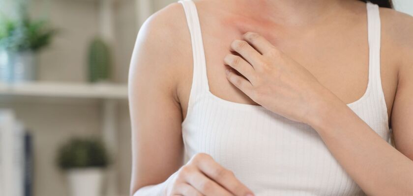 alergia skórna, alergie skórne, wysypka na skórze, uczulenie, wysypka na rękach