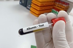 Test na albuminy