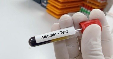 Test na albuminy