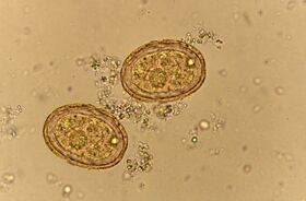 Jaja glisty ludzkiej pod mikroskopem. Glista ludzka, glistnica.