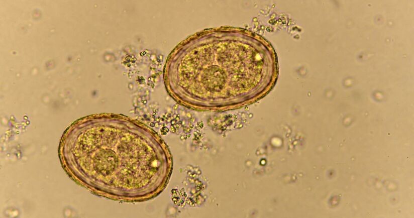 Jaja glisty ludzkiej pod mikroskopem. Glista ludzka, glistnica.