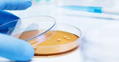 Zdjęcie przedstawia laboratorium, gdzie badane są bakterie i mikrobiom