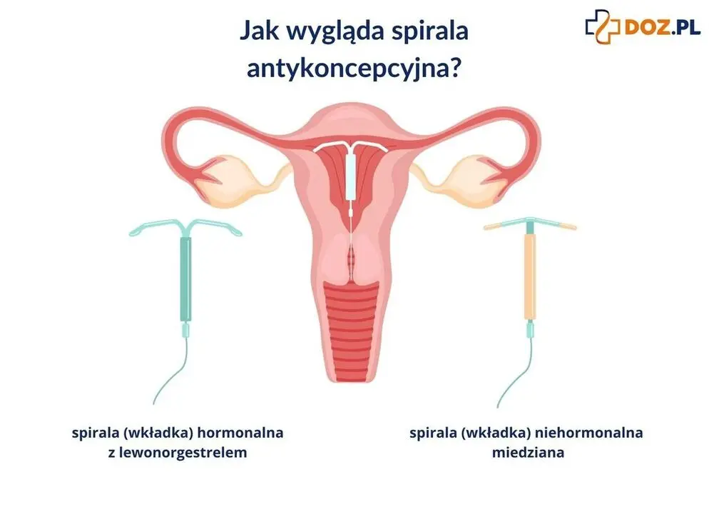 Jak wygląda spirala antykoncepcyjna?