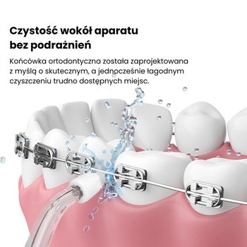 Oclean Dysze (końcówki) ortodontyczne N11 do irygatora W10, 2 szt.