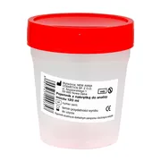 Pojemnik na mocz z nakrętką, niejałowy, 120 ml https://azcdn.doz.pl/image/d/product/06e0298e-scale-180x180.webp