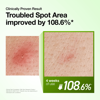 Anua Azelaic Acid10 Hyaluron Redness Soothing, serum kojące, 30 ml