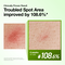 Anua Azelaic Acid10 Hyaluron Redness Soothing, serum kojące, 30 ml