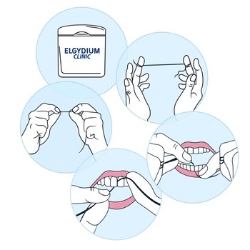 Elgydium Clinic Dental Floss, nić dentystyczna czarna, 50 m