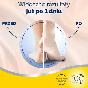 Scholl, krem regenerujący na popękane pięty, 120 ml