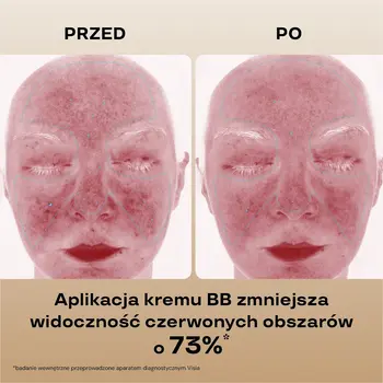 BasicLab Beauties, nawilżający krem,BB SPF15, Honey, 33 ml