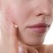 Idee Derm, krem niwelujący niedoskonałości z kwasem salicylowym, 50 ml