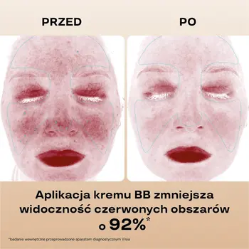 BasicLab Beauties, nawilżający krem,BB SPF15, Beige, 33 ml