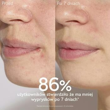 Caudalie Vinopure, serum na niedoskonałości z kwasem salicylowym, 30 ml