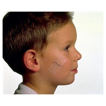 Viscoplast Steri-Strip, paski do zamykania ran, białe, 8 szt.