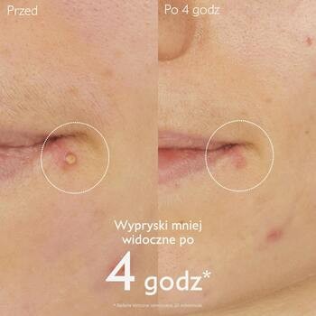 Caudalie Vinopure, punktowy żel z kwasem salicylowym, 15 ml