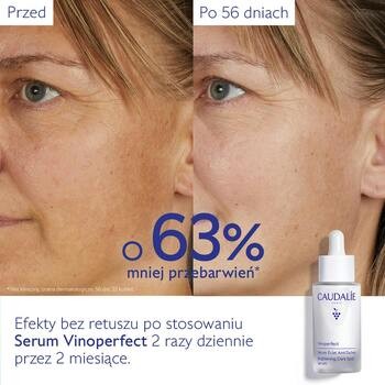 Caudalie Vinoperfect, serum rozjaśniające przebarwienia, 50 ml