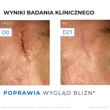 Uriage Bariederm CICA, krem regenerujący, Cu-Zn, 100 ml