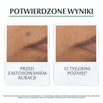 Eucerin DermoPure, serum o potrójnym działaniu z Thiamidolem do skóry ze skłonnością do trądziku, 40 ml