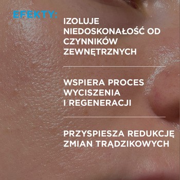 Idee Derm, żel punktowy na wypryski, 15 ml