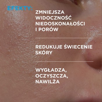 Idee Derm, dermatologiczny tonik mikrozłuszczający, 220 ml