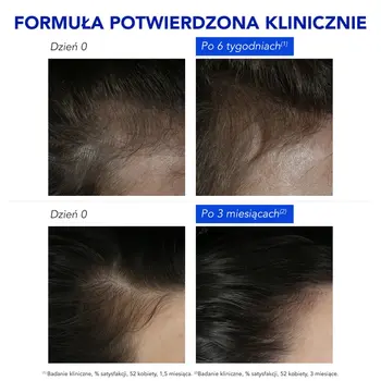 Phyto Phytophanere, kuracja przeciw reakcyjnemu wypadaniu włosów, 12 x 5 ml