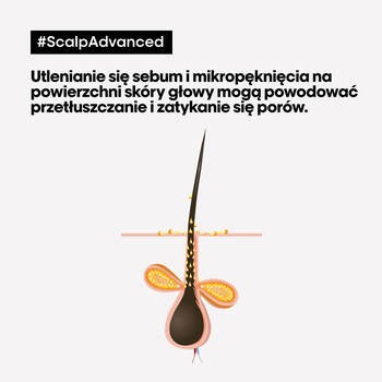 L'Oreal Scalp Advanced, szampon oczyszczający, 1,5 l