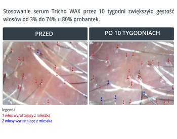 WAX Tricho, serum na wypadanie włosów bez spłukiwania, 100 ml