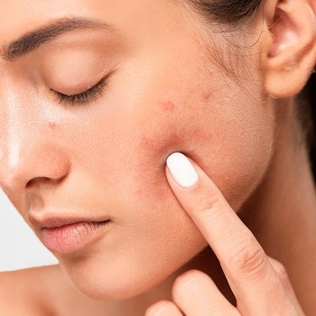 Idee Derm, dermatologiczny żel normalizujący do mycia twarzy, 220 ml