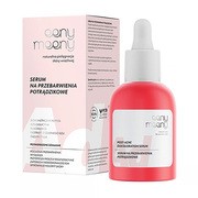 Eeny Meeny, serum na przebarwienia potrądzikowe, 30 ml https://azcdn.doz.pl/image/d/product/e91a5c49-scale-180x180.png