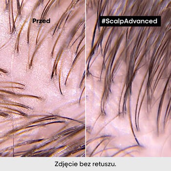 L'Oreal Scalp Advanced, szampon oczyszczający, 1,5 l