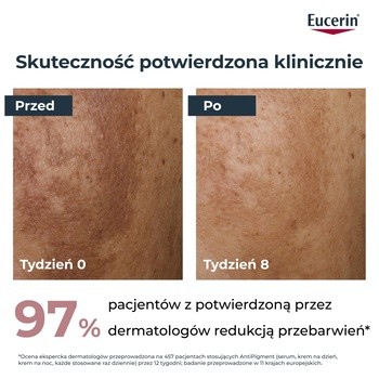 Eucerin Anti-Pigment, serum o podwójnym działaniu z Thiamidolem, przeciw przebarwieniom, 30 ml