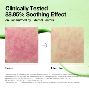 Anua Azelaic 10 + Hyaluron Redness Soothing, płatki tonizujące do twarzy, 90 szt.