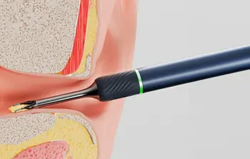 Bebird Otoskop Bebird Note5 Pro do usuwania wosku z kamerą, niebieski, 1 szt.