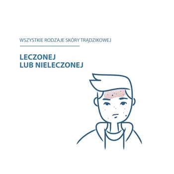Ducray Keracnyl, żel pieniący, 200 ml