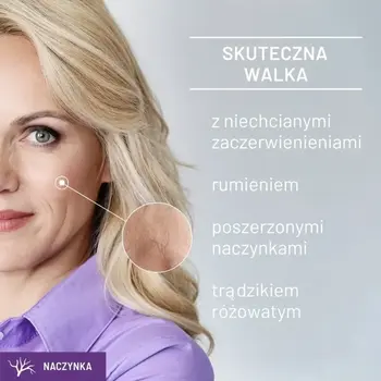 Sylveco Dermo Naczynka, peeling kwasowy na naczynka, 30 ml