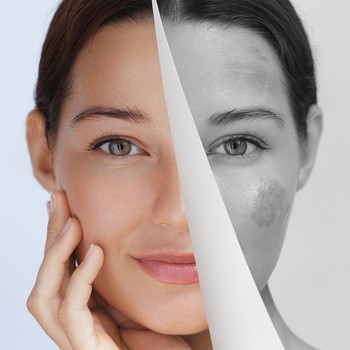 Miraculum Anti-Pigmentation, krem do rąk korygujący przebarwienia, 75 ml