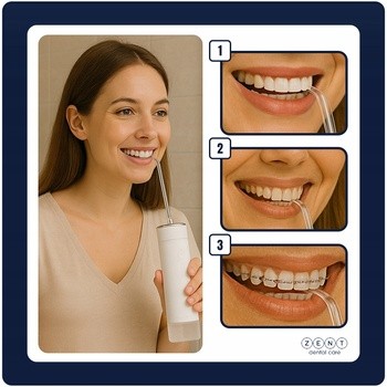 Zent Stream+, bezprzewodowy irygator do zębów, biały, 1 szt.